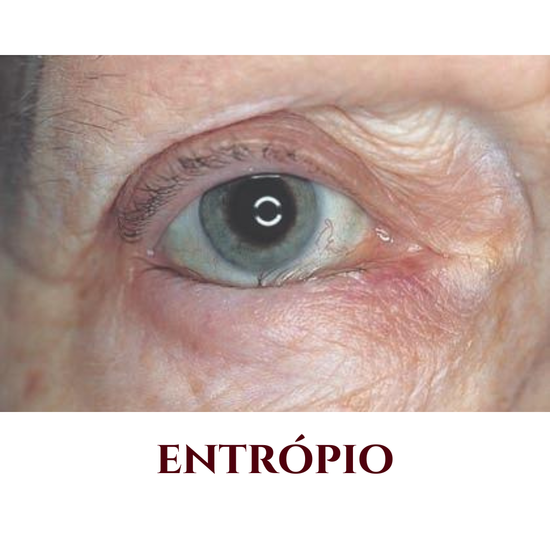 entrópio valinhos - entrópio vinhedo - entrópio campinas