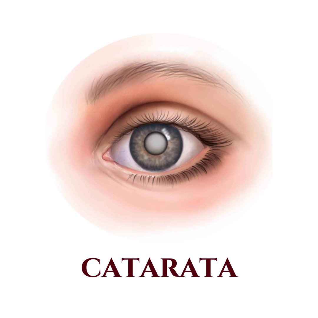 Catarata Valinhos - Catarata Vinhedo - Catarata Campinas